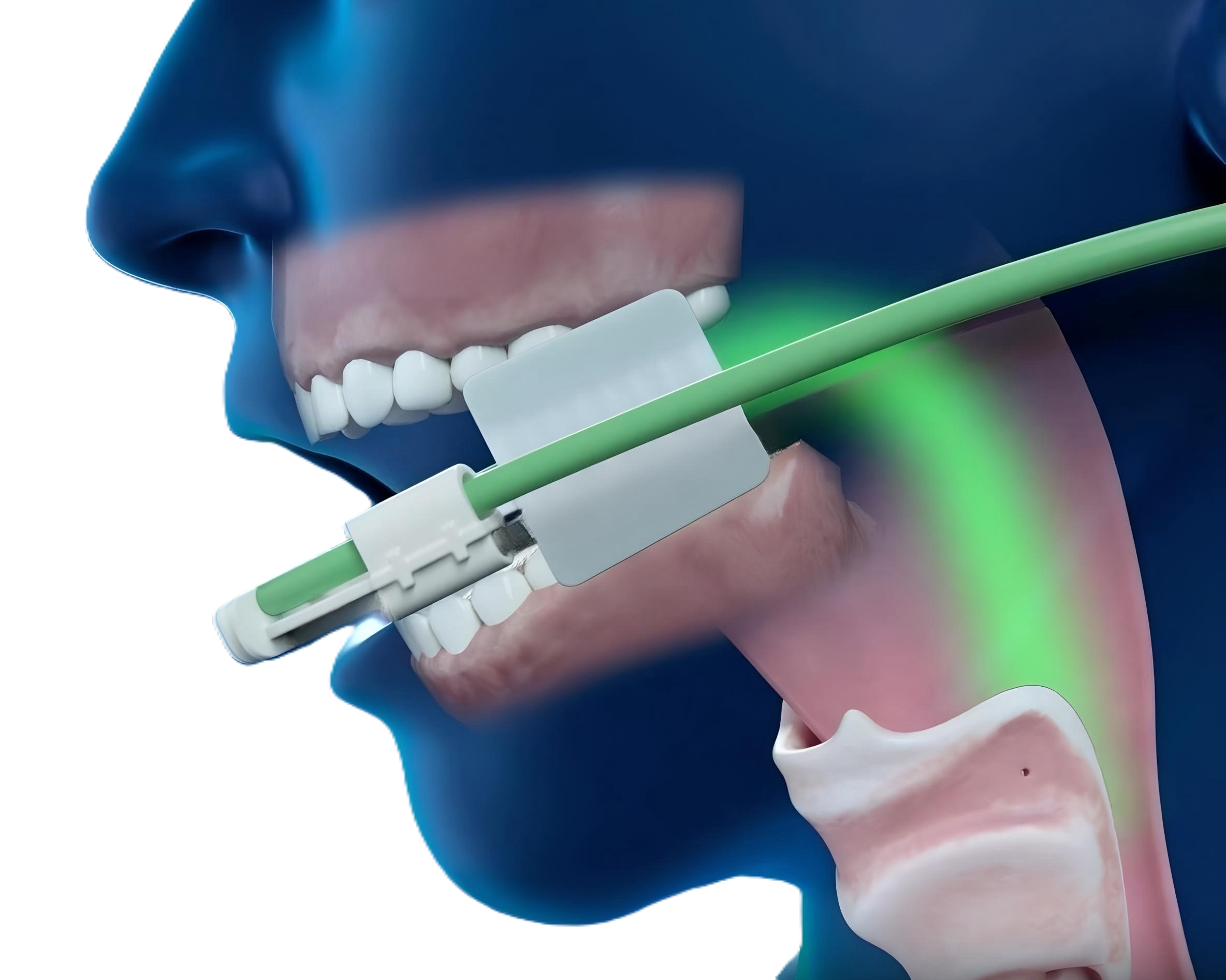 AIM showing flow of oxygen into the oropharynx